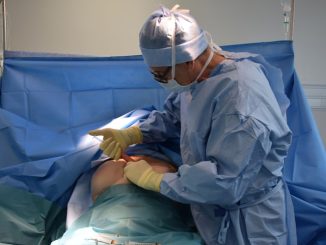 Liposuccion à Marseille