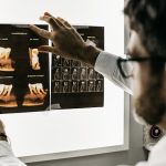 Maladies osseuses